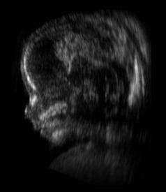 What We Learned Here: Parturition (REVIEW)